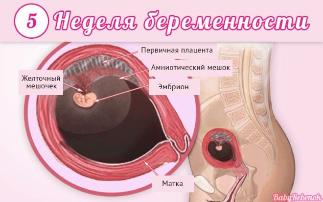 Узи беременность Уфа
